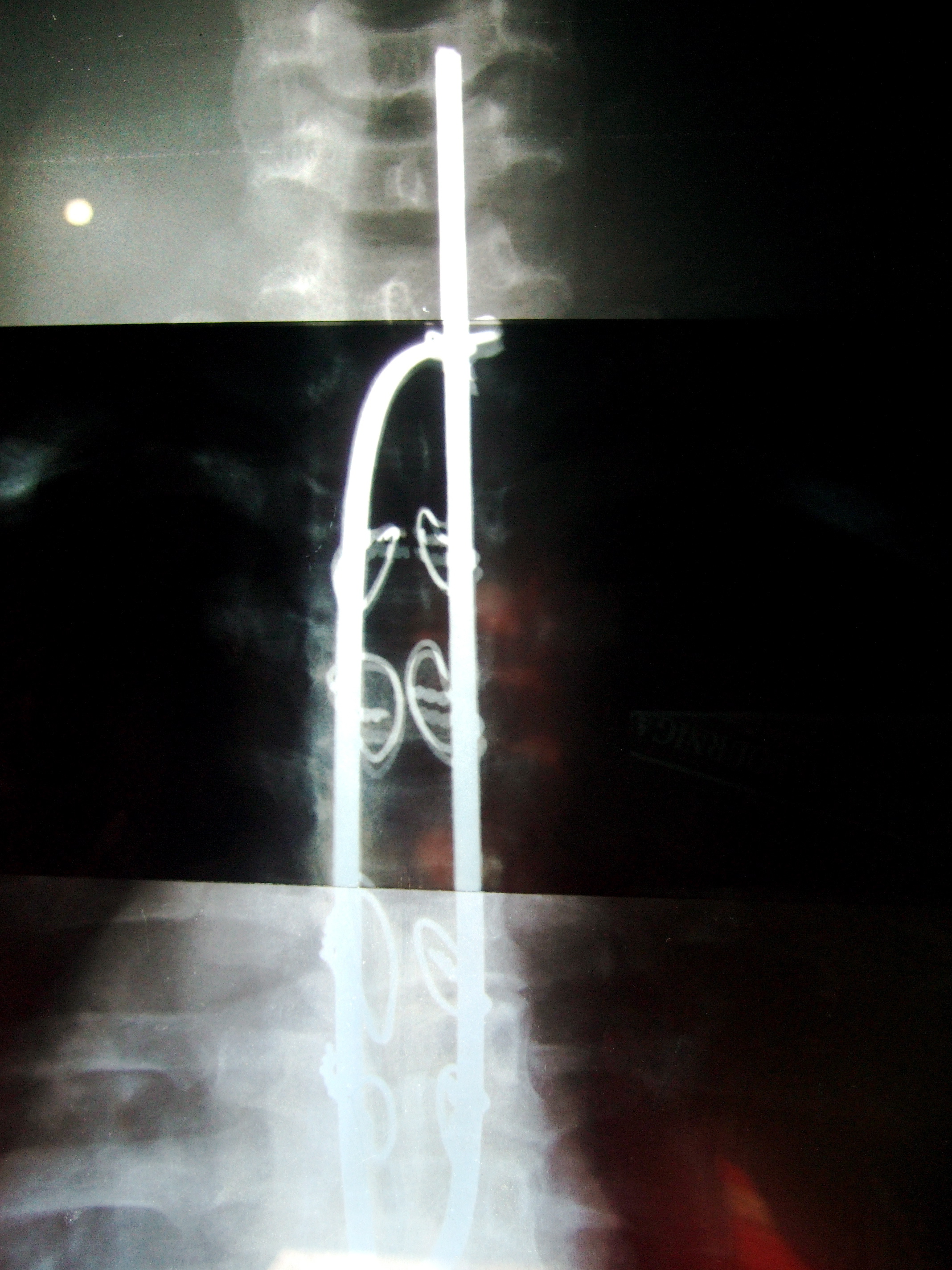 xray2