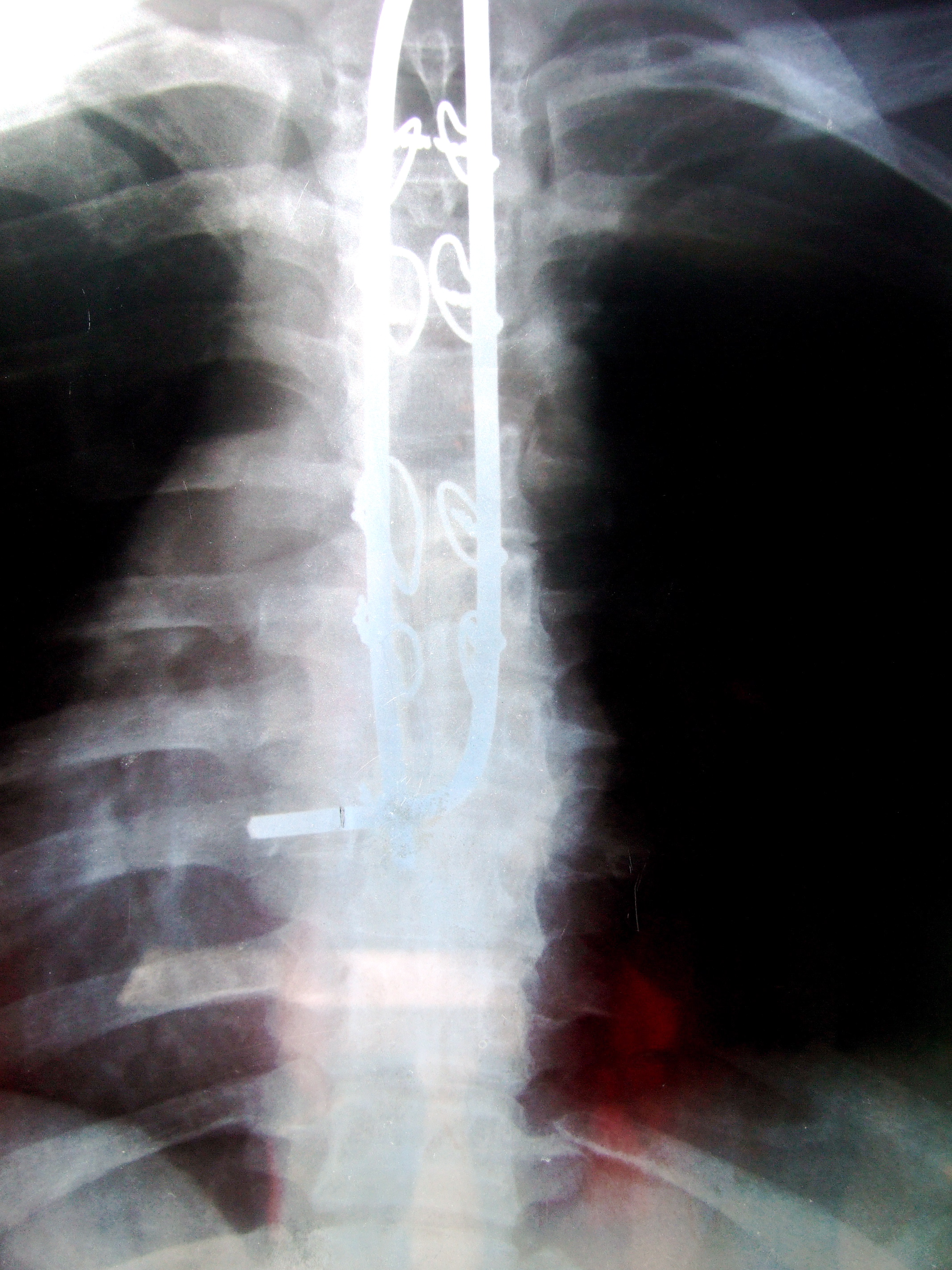 xray4